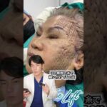 整形失敗…? やばいフェイスリフト #shorts