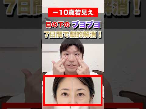 【目のたるみ解消】目元が劇的に若返る方法をご紹介します！