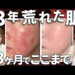 【必見】電位治療器の電場とは？睡眠・疲労回復・美容への効果を美容のプロが解説│DENBAお客様の声
