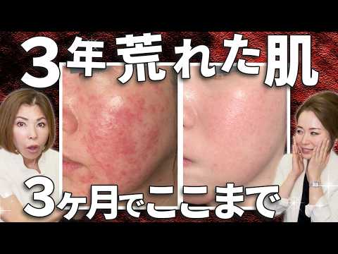 【必見】電位治療器の電場とは？睡眠・疲労回復・美容への効果を美容のプロが解説│DENBAお客様の声