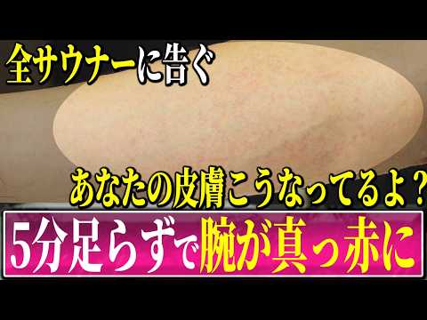 肌がツルツル、モチモチになるはずの美容・健康法を検証してみたら、赤くなって痒くなりました。