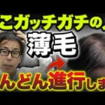 【放置しないで】白髪・薄毛を改善！1日1分で「頭皮を耕す」リンパケア　これならどれがいい？